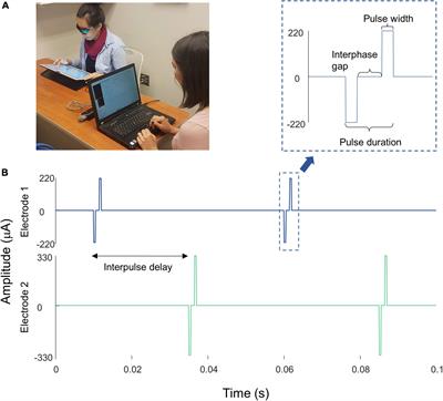 Factors affecting two-point discrimination in Argus II patients